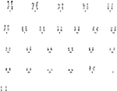 Case Report: How whole-genome sequencing-based cell-free DNA prenatal testing can help identify a marker mhromosome